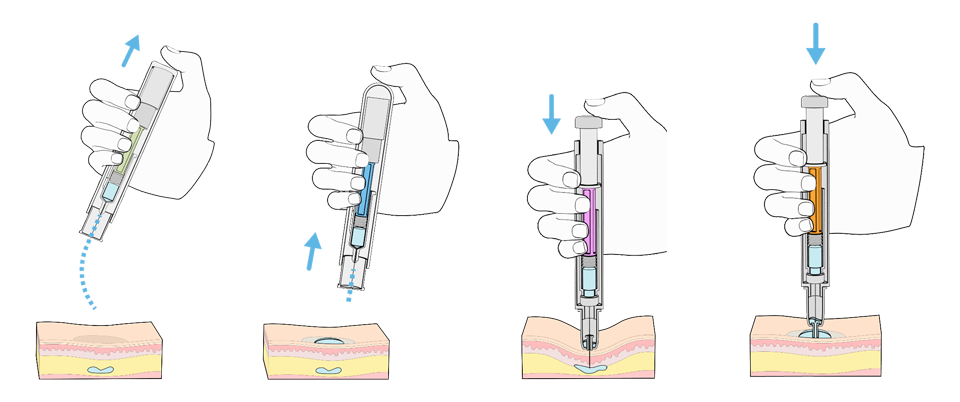 Image: Various types of medical device wet injections