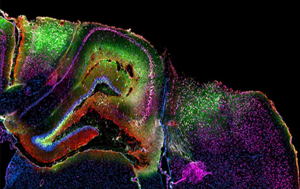 Image: Brain sections with nanomaterials modified by peptides visible